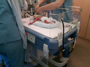 Säugling im Wärmebett wird von Pflegepersonal versorgt